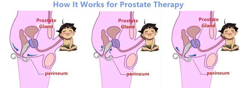 Pulse Magnetic Prostate Glands Massaging Therapy Device Prostate Massager Vibrating Treatment Machine Medical Silicone Materials 5