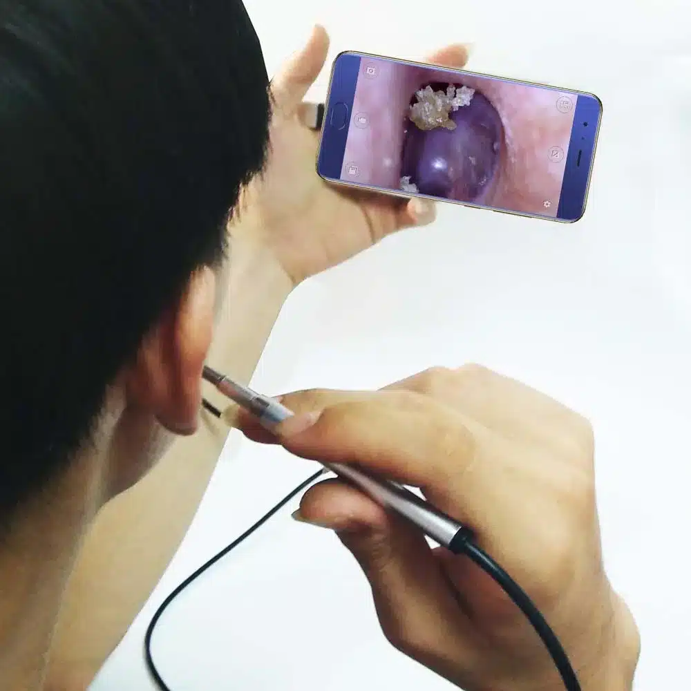 Medical Endoscope Camera 3.9MM Mini Waterproof USB Endoscope Inspection Camera For OTG Android Phone PC Ear Nose Borescope 19