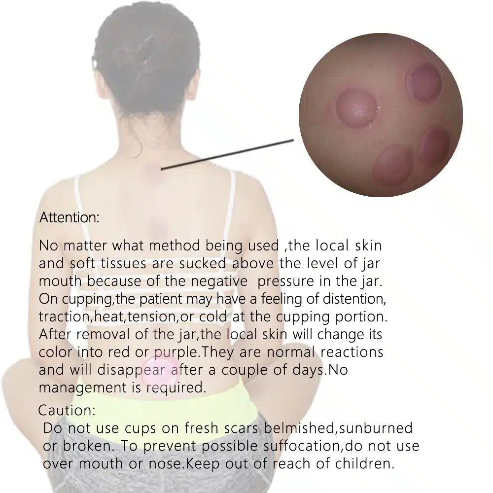 3PCS Massage Cupping Cups Full Body&Face Chinese Vacuum Therapy Cupping Set For Anti-Cellulite Pain Relief 9