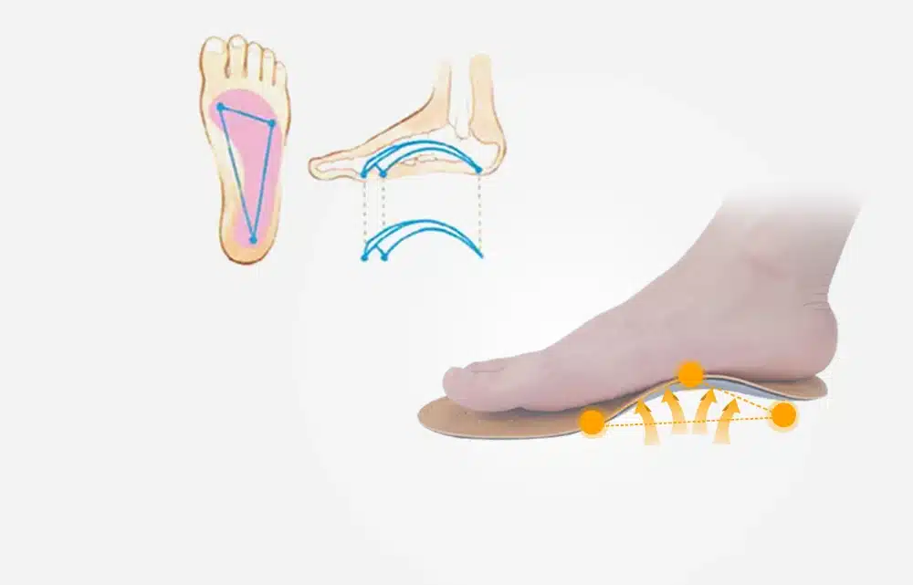 EXPfoot High quality Leather orthotics Insole for Flat Foot Arch Support 25mm orthopedic Silicone Insoles for men and women 25 32
