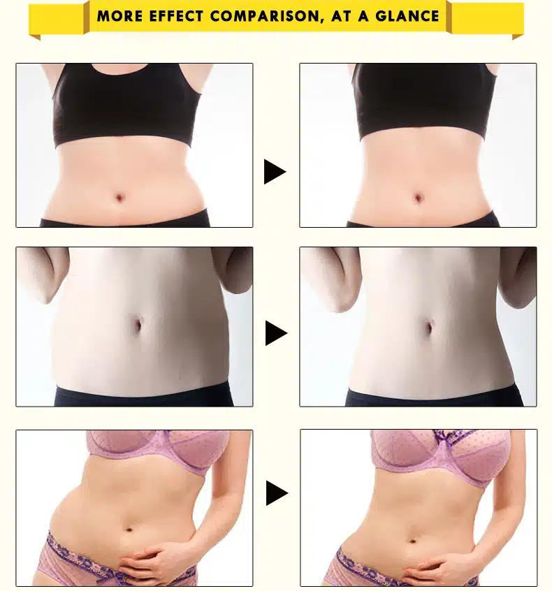 OEDO Hyaluronic Acid Ginseng Slimming Cream Reduce Cellulite Lose Weight Burning Fat Slimming Cream Health Care Burning Creams 16