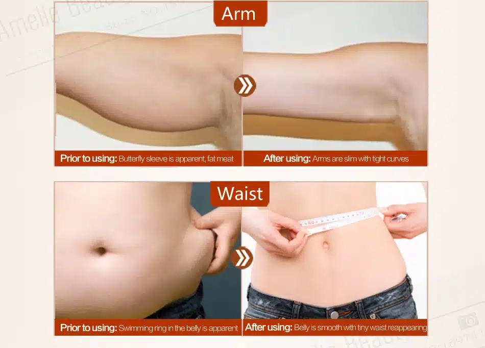 MEIKING Slimming Cream Skincare Reduce Cellulite Lose Weight Loss Burning Fat Slimming Cream Health Care Burning Creams 80g 23