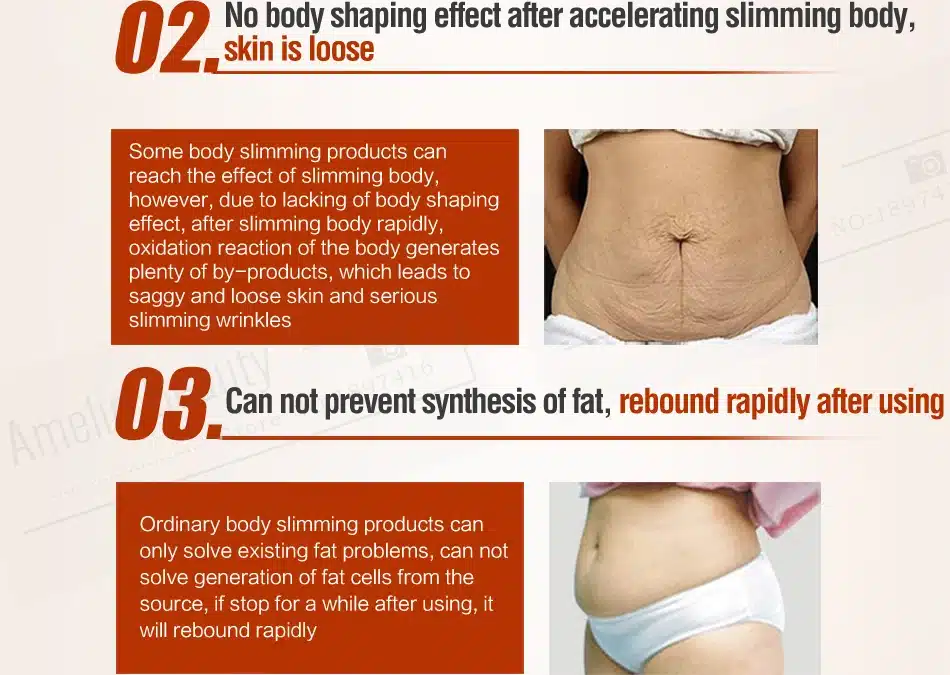 MEIKING Slimming Cream Skincare Reduce Cellulite Lose Weight Loss Burning Fat Slimming Cream Health Care Burning Creams 80g 26