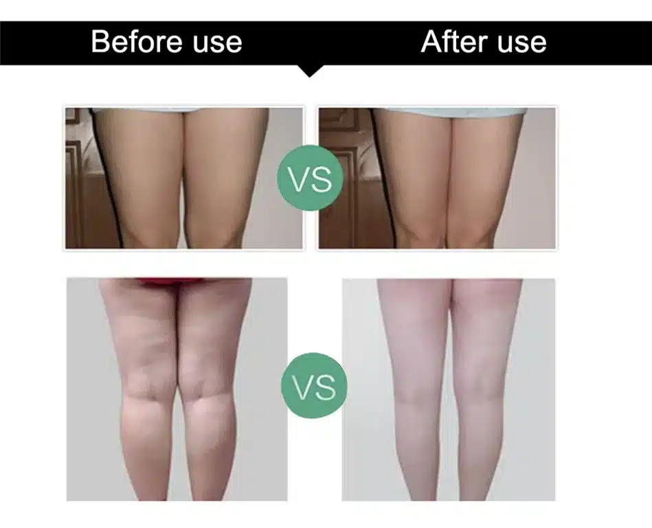 QBEKA Body Slimming Cellulite Cream Fat Burn Creams Thin Legs & Hands Arms Anticellulite Weight Loss Slimming Products 10