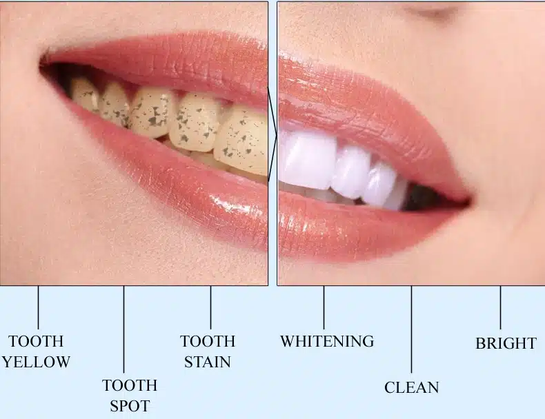 MeiYanQiong Oral CleansingTeeth Whitening Essence Effectively Removes Tartars Teeth Cleaning Oral Hygiene Dental Tools Oral Care 8
