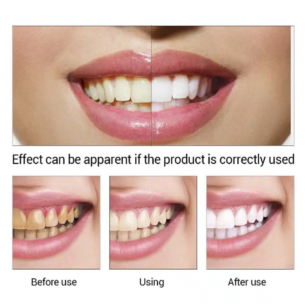 New Oral teeth whitening clean Home Use Teeth Stains Scaling Tool Tooth Stain Remover Tartar Dental Scaler Cleansing Machine 24