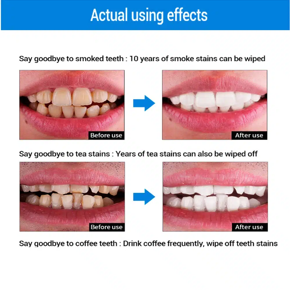 New Oral teeth whitening clean Home Use Teeth Stains Scaling Tool Tooth Stain Remover Tartar Dental Scaler Cleansing Machine 27