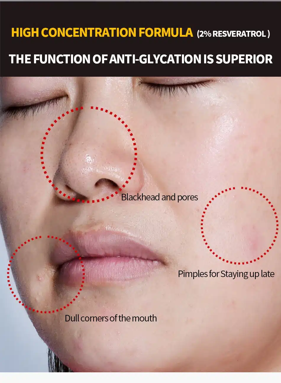 MEIKING Anti Aging Face Cream Anti Acne Pimple Spot Resveratrol Moisturizing Facial Cream Whitening Beauty Skin Care Cream 30g 10