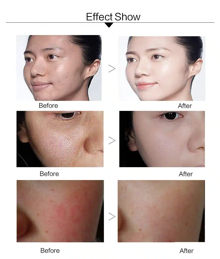 efero Snail Cream Moisturizing Face Cream for Snail Repair Anti Aging Essence Face Whitening Cream Wrinkles Firming Skin Care 17