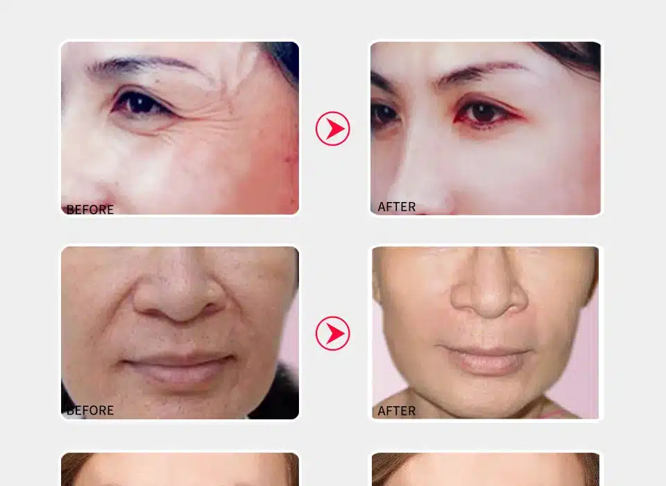 SOMILD Ginseng Face Cream Anti Aging Wrinkle Remover Skin Care Moisturizing Firming Day Cream Korean Whitening Cream for Face 17