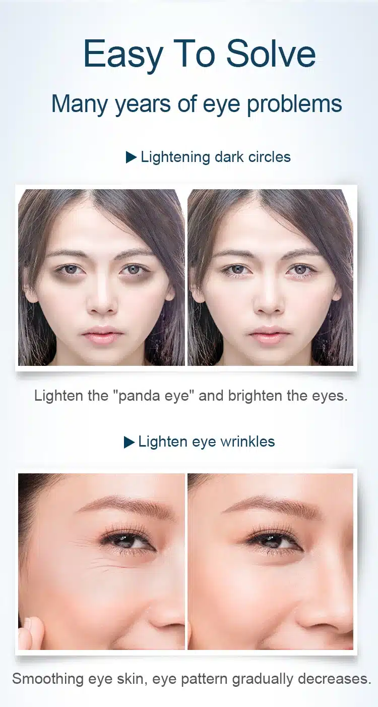 Korean Skin Care Anti Wrinkle Eye Cream Six Peptides Serum Anti Aging Remover Dark Circle Bag Firming nourish eye Balm Mask 20g 12