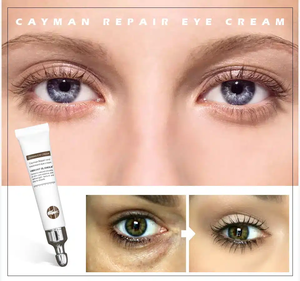 VIBRANT GLAMOUR Anti Wrinkle Eye Cream Moisturizing Remover Dark Circles Against Puffiness Bags Anti-aging Eye Care Fat Granule 10