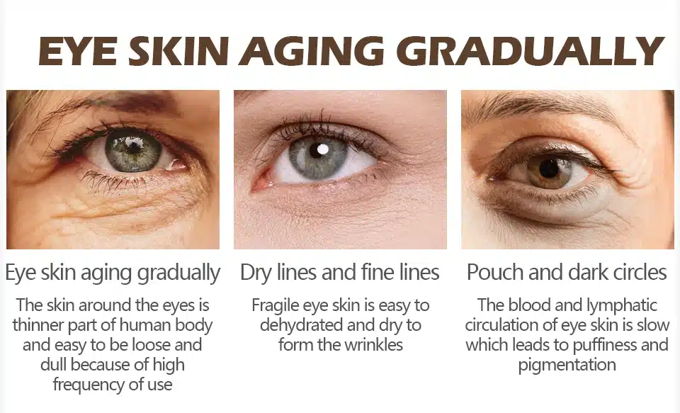 VIBRANT GLAMOUR Anti Wrinkle Eye Cream Moisturizing Remover Dark Circles Against Puffiness Bags Anti-aging Eye Care Fat Granule 11
