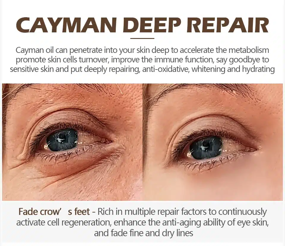 VIBRANT GLAMOUR Anti Wrinkle Eye Cream Moisturizing Remover Dark Circles Against Puffiness Bags Anti-aging Eye Care Fat Granule 13