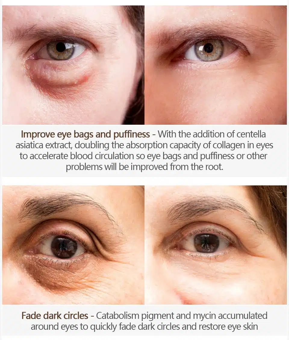 VIBRANT GLAMOUR Anti Wrinkle Eye Cream Moisturizing Remover Dark Circles Against Puffiness Bags Anti-aging Eye Care Fat Granule 14