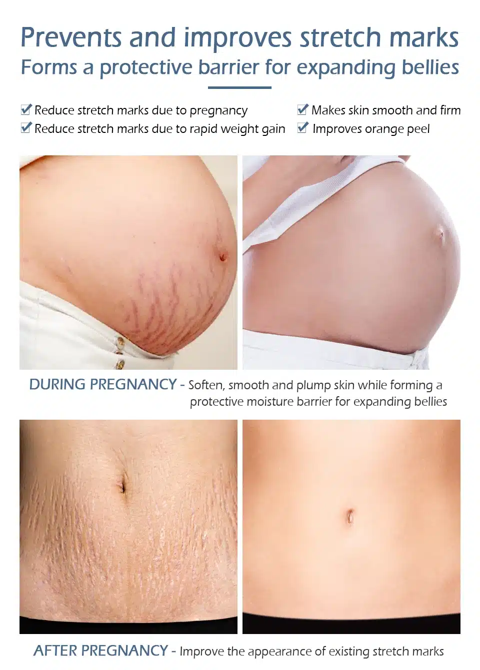 VIBRANT GLAMOUR Crocodile Stretch Marks Remover Pregnancy Scars Ance Cream Maternity Repair Anti Aging Winkles Firming Body Care 13