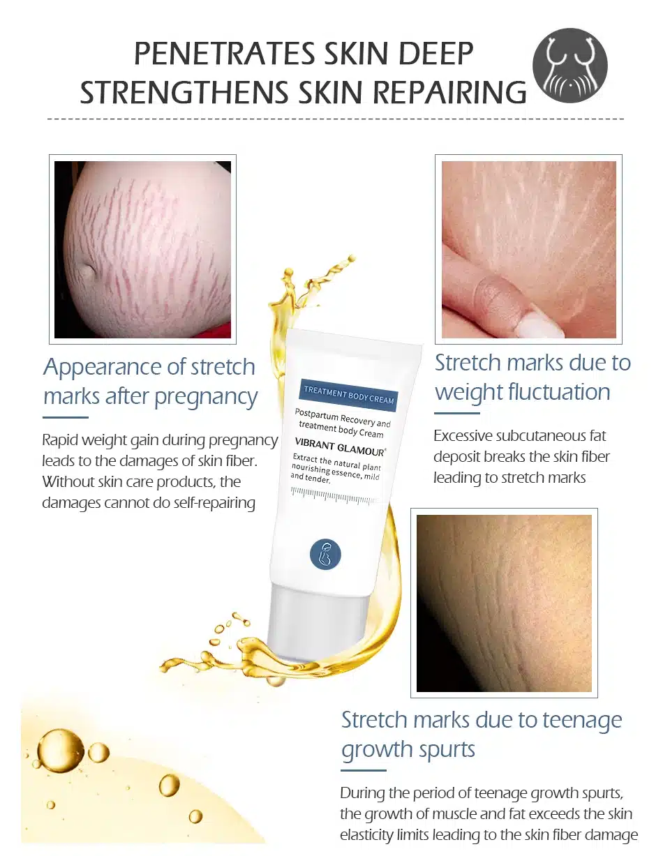 VIBRANT GLAMOUR Crocodile Stretch Marks Remover Pregnancy Scars Ance Cream Maternity Repair Anti Aging Winkles Firming Body Care 15