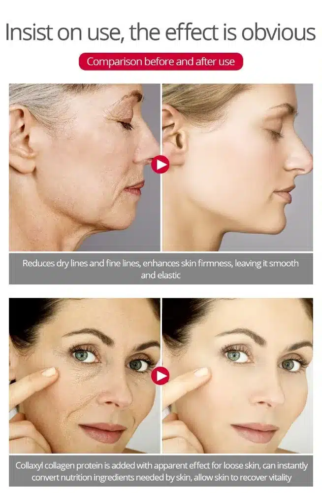 30ml Six Peptides Face Cream Argireline Pure Collagen Cream Anti-wrinkle Firming Anti Aging Acne Whitening Moisturizing Cream 14