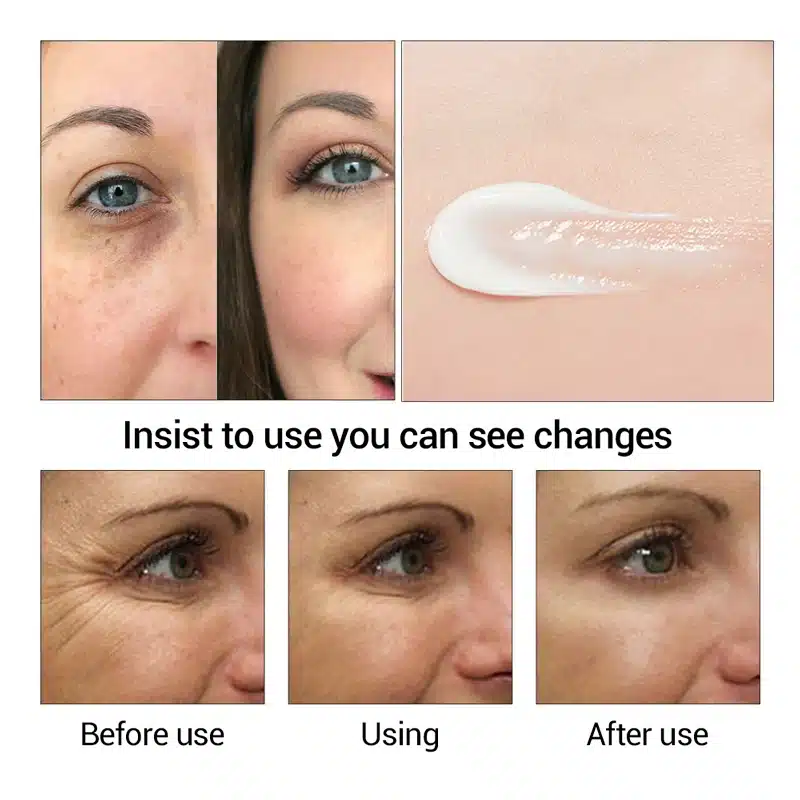 EFERO Moisturizing Eye Cream Collagen Deep Repair Dark Circle Eye Essence Cream Anti Aging Wrinkle Cream for Eye Care Nourishing 10