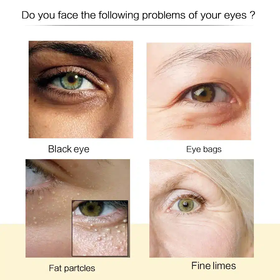 EFERO Moisturizing Eye Cream Collagen Deep Repair Dark Circle Eye Essence Cream Anti Aging Wrinkle Cream for Eye Care Nourishing 12