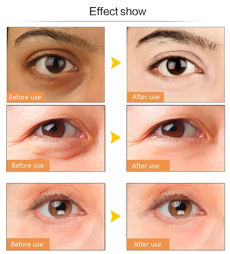 EFERO Moisturizing Eye Cream Collagen Deep Repair Dark Circle Eye Essence Cream Anti Aging Wrinkle Cream for Eye Care Nourishing 16