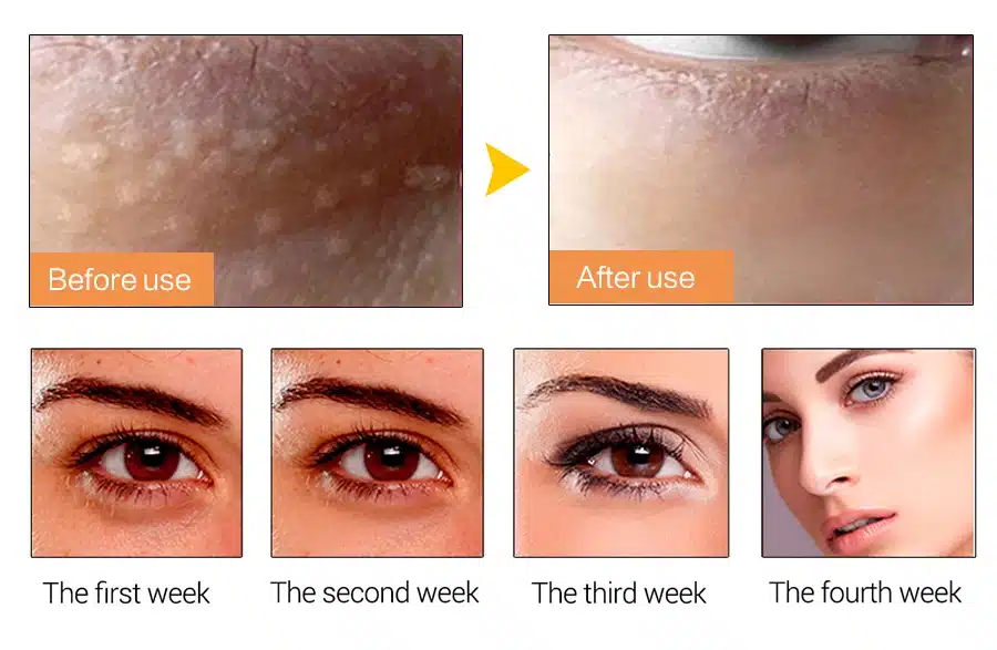 EFERO Moisturizing Eye Cream Collagen Deep Repair Dark Circle Eye Essence Cream Anti Aging Wrinkle Cream for Eye Care Nourishing 17