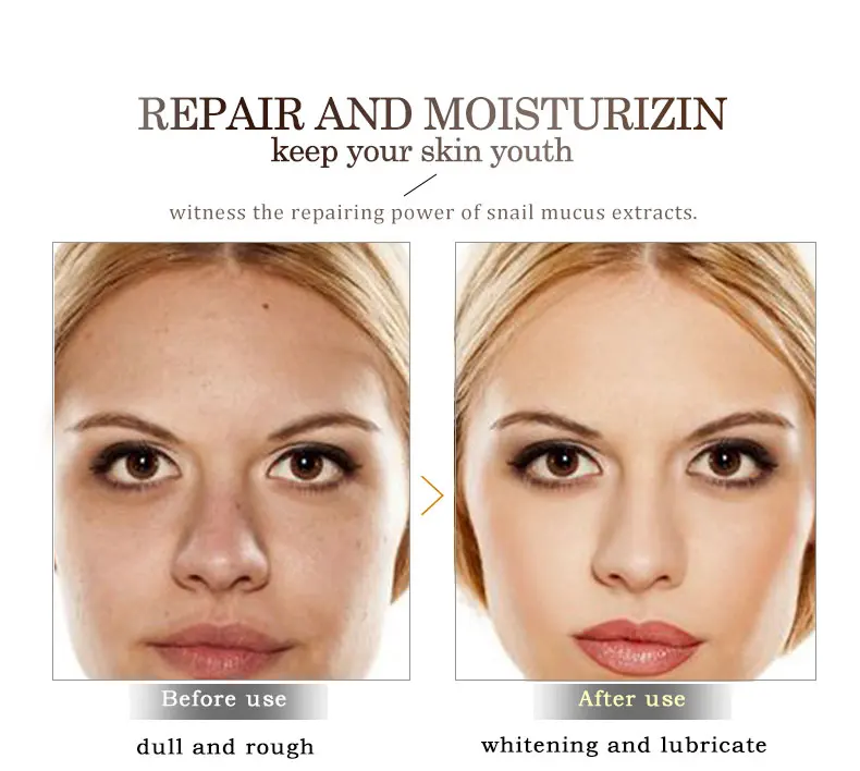 ARTISCARE Snail Repair Facial Cream Aging Aniti Oil-Control Face Cream Anti Wrinkle Shrink Pores Moisturizing Lifting Skin Care 19