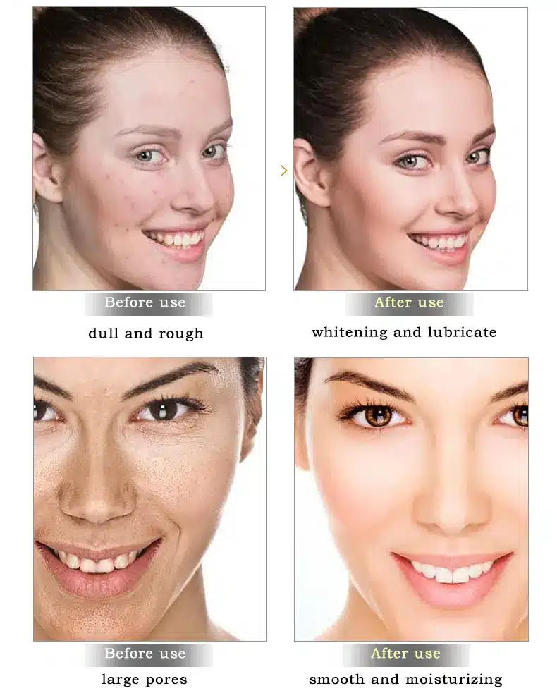 ARTISCARE Snail Repair Facial Cream Aging Aniti Oil-Control Face Cream Anti Wrinkle Shrink Pores Moisturizing Lifting Skin Care 20