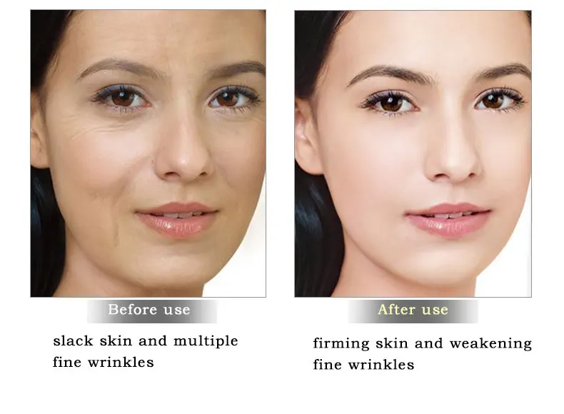 ARTISCARE Snail Repair Facial Cream Aging Aniti Oil-Control Face Cream Anti Wrinkle Shrink Pores Moisturizing Lifting Skin Care 21