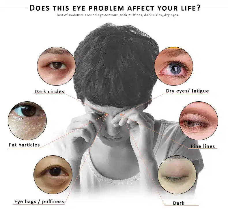 ARTISCARE Peptide Anti Wrinkles Eye Serum Roller Massager Eye Patches Skin Care Anti Puffiness Fine Lines Dark Circles Eye Cream 15