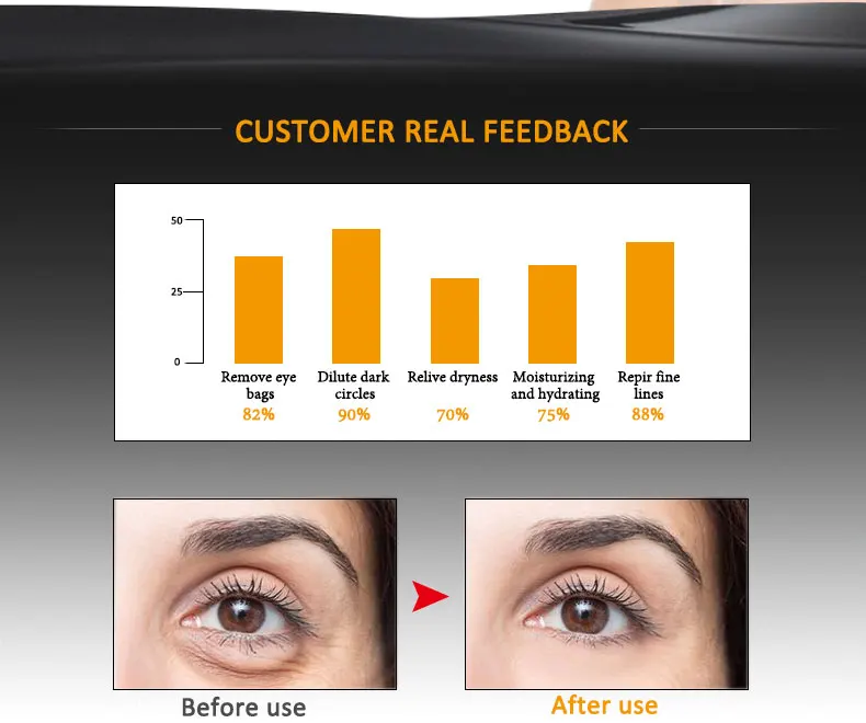 ARTISCARE Peptide Anti Wrinkles Eye Serum Roller Massager Eye Patches Skin Care Anti Puffiness Fine Lines Dark Circles Eye Cream 20