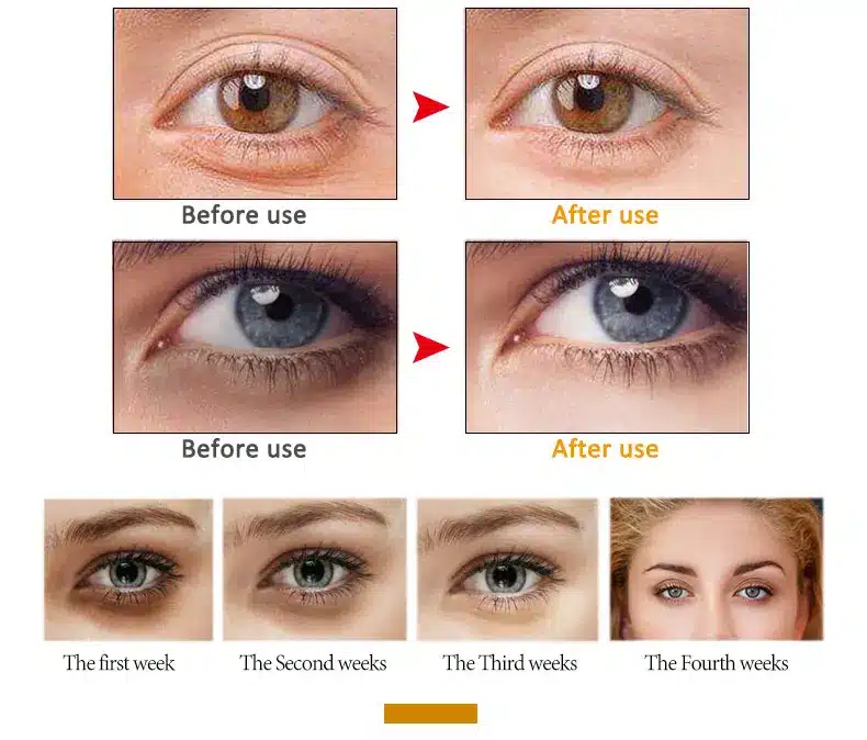 ARTISCARE Peptide Anti Wrinkles Eye Serum Roller Massager Eye Patches Skin Care Anti Puffiness Fine Lines Dark Circles Eye Cream 21