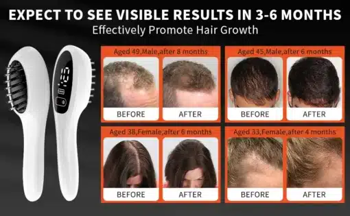 Efektiivne laserteraapia kamm juuksekasvu suurendamiseks | E-pood Tootemaailm Efektiivne laserteraapia kamm juuksekasvu suurendamiseks, valge käepidemega, näidatud koos enne ja pärast fotodega. Pildil on erinevas vanuses inimesed erinevate juustekasvu tulemuste ja ajaga, hallist taustast silma paistva tekstiga 'Expect to see visible results in 3-6 months'.