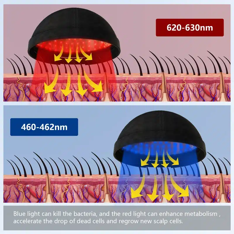 Diagramm, mis näitab Kvaliteetne LLLT teraapiaseade kiilanemise vastu kasutamist: punane ja sinine valgusravi peanaha kohal, näidates valguse lainepikkusi ja toimet juuksefolliikulitele.