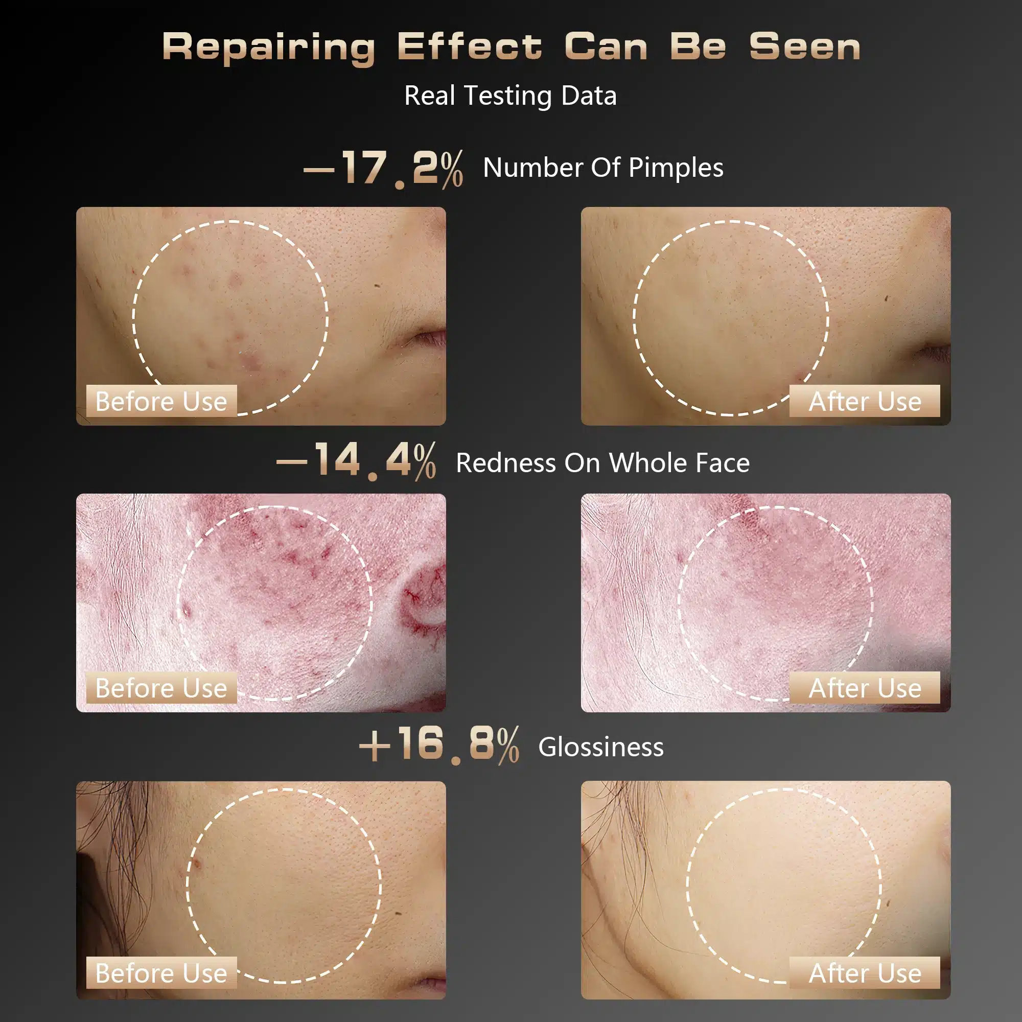 Efektiivne valgusteraapia mask näonaha pingutamiseks ja noorendamiseks; neljast pildist koosnev kollaaž, mis näitab naha olukorra paranemist: punnide vähenemine, punetuse alanemine ning läike suurenemine pärast toote kasutamist. Taust on tume, esile toodud protsendilised muutused.