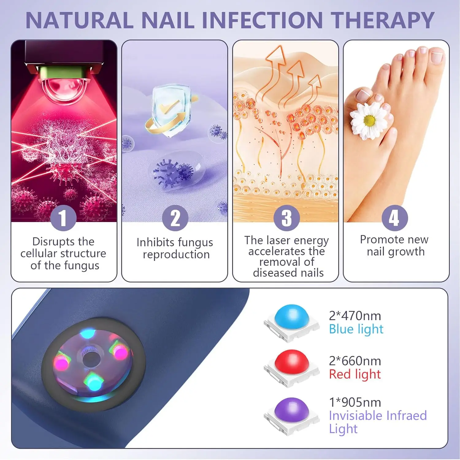 Efektiivne laserteraapia seade küüneseene raviks, illustreeritud nelja etapiga: seene rakustruktuuri häirimine, seene paljunemise tõkestamine, kahjustatud küünte eemaldamise kiirendamine ja uue küünte kasvu soodustamine. Pildil on ka erineva valguse näitajad, sealhulgas sinine, punane ja nähtamatu infrapuna valgus.