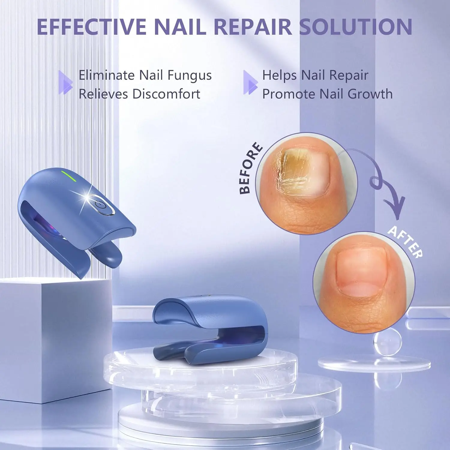 Efektiivne laserteraapia seade küüneseene raviks. Sinine kaasaegne seade läbipaistval alusel, mille kõrval on küünte enne ja pärast pildid. Taustal on helged toonid ja tekstiil.