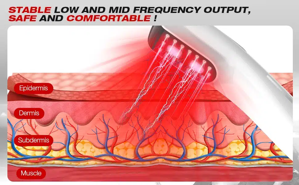 Professionaalne külmlaserteraapia seade suunamas punast valguskiirt inimese naha erinevatele kihtidele, sealhulgas epidermise ja derma vahele, et leevendada lihas- ja liigesevalu.