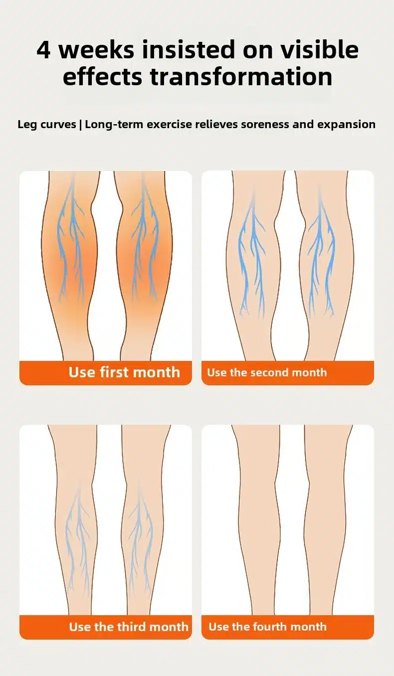 Illustratsioon näitab progressi jalgade veenilaiendite vähenemisel Soodne õhusurvega massaažiseade jalgadele veenilaiendite raviks kasutamisega nelja kuu vältel. Pildid kujutavad järk-järgulisi muutusi jalgade välimuses alates esimesest kuust kuni neljanda kuuni. Taust on hele, märkega igale kuule vastavalt.