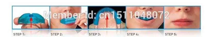 New 2Pcs/lot Dental Tooth Orthodontic Appliance Trainer Alignment Braces Mouthpieces On Sale Teeth Care 13