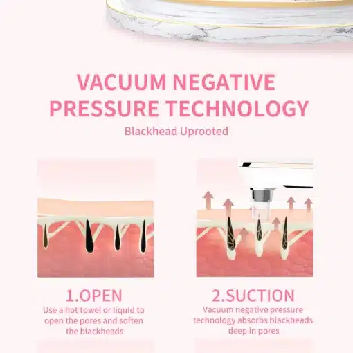 Mild-And-Effective-Defect-Removal-Skincare-Tools-Blackhead-Removal-Instrument-Acne-Removal-Pore-Cleaning-Spot-And-5 – saadaval Tootemaailm e-kaubamajas
