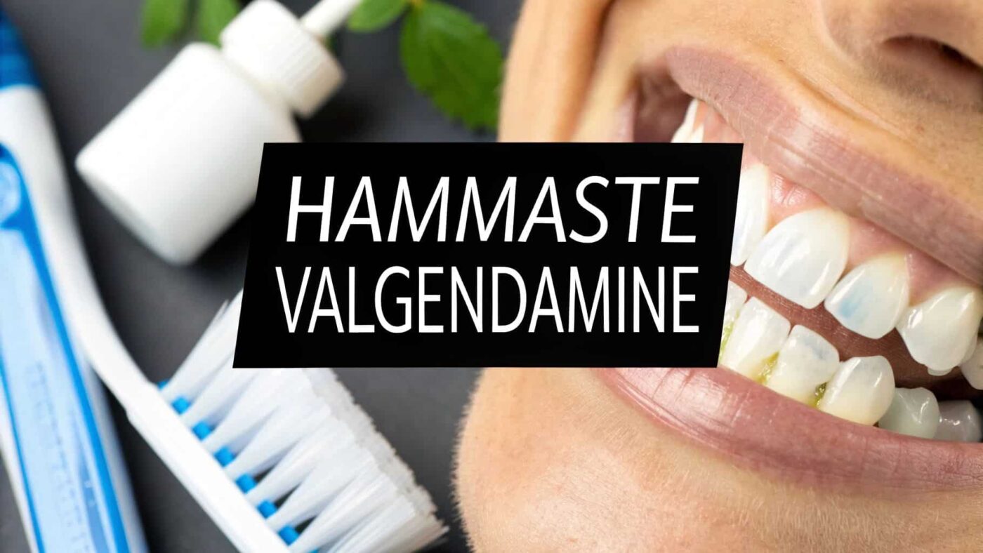 Kuidas valgendada hambaid kodus? | E-pood Tootemaailm Hammaste valgendamine kodus